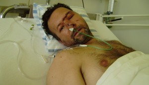 Der am Beverin verunglückte Patrik Stalder 10 Tage nach dem Unfall (Foto: Staatsfernsehen)